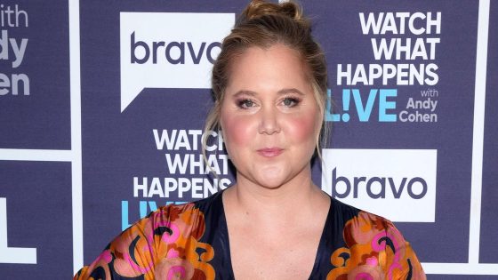 Amy Schumer says criticism of her rounder face led to diagnosis of Cushing syndrome – MASHAHER