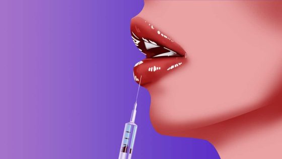 Is filler finished? The changing face of cosmetic injectables – MASHAHER