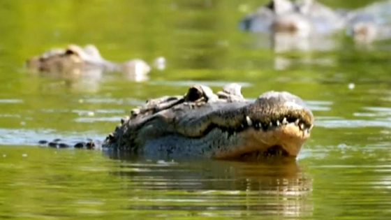 Crocodile attack victim shares story of survival – MASHAHER