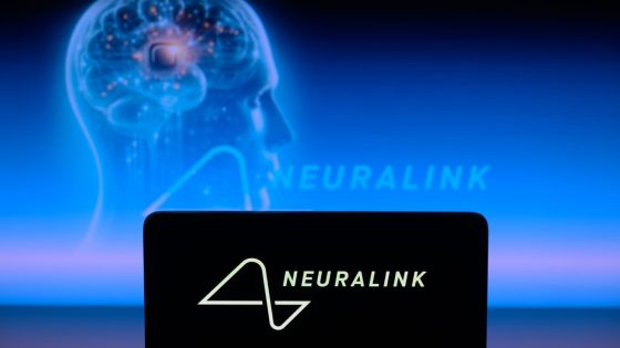 Neuralink shows video of patient chess player involving brain implant – MASHAHER