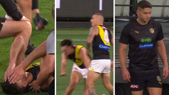 Richmond injuries vs Carlton, Josh Gibcus knee injury, Dion Prestia hamstring injury, video, highlights, latest news – MASHAHER