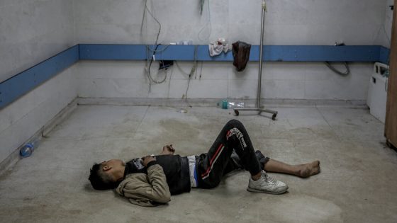 Witnesses Describe Fear and Deprivation at Besieged Hospital in Gaza – MASHAHER