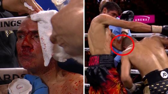 Tim Tszyu cut in fight against Sebastian Fundora, stoppage, ref, update, fight highlights – MASHAHER