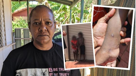 Relative that witnessed Broome kids being restrained in cable ties reveals horrifying details – MASHAHER