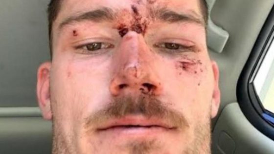 Cops deny assaulting NRL star Tom Starling in brawl – MASHAHER