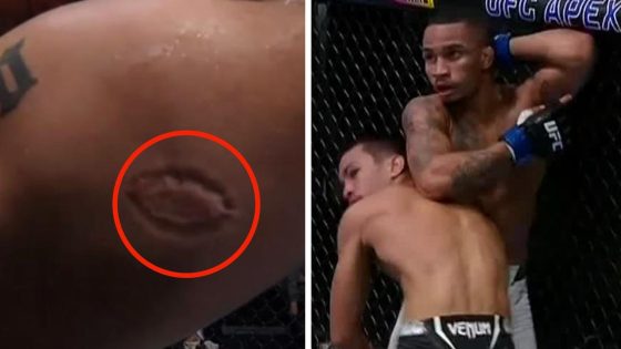 Igor Severino disqualified from fight for biting Andre Lima, pictures, Igor Severino to be cut from UFC, latest, updates – MASHAHER