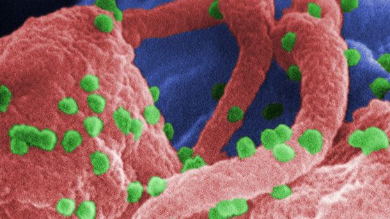 Hopes of HIV cure after breakthrough using gene-editing ‘scissors’ | Science & Tech News – MASHAHER