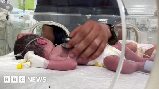 Gaza baby saved from dead mother's womb – MASHAHER