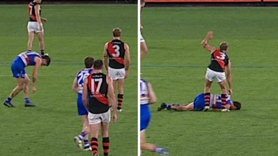 Tom Liberatore collapses, video, what happened, explained, tweaked ankle, concussion Western Bulldogs v Essendon Bombers, Luke Beveridge press conference – MASHAHER