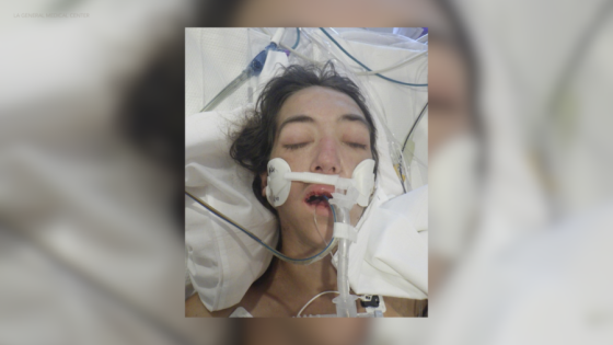 Hospital looking to identify woman found at downtown L.A. apartment complex – MASHAHER