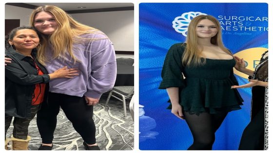 These Ozempic Before and After Photos Give a Real-Life Glimpse of What Life is Like on Weight Loss Medication – MASHAHER