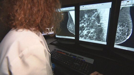 Data shows women are not getting recommended screenings for breast cancer – MASHAHER