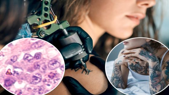 Possible link between tattoos and lymphoma revealed in new study – MASHAHER