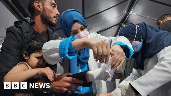 Israeli operation leaves Rafah’s hospitals overwhelmed – MASHAHER