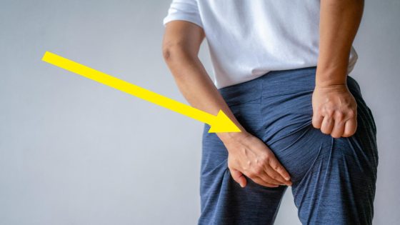 “Dead Butt Syndrome” Is A Real Thing — Here’s How To Tell If You Have It – MASHAHER