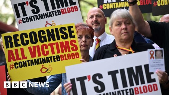 Scottish blood victims were 'studied without knowledge' – MASHAHER