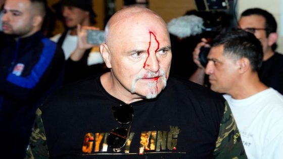 Watch: John Fury left bleeding after clash with Usyk’s team ahead of son Tyson’s unification fight – MASHAHER