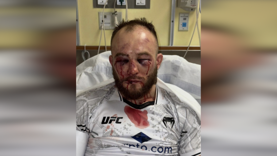 Photo: Mateusz Rebecki reveals horrifying facial damage from brutal UFC on ESPN 56 loss – MASHAHER