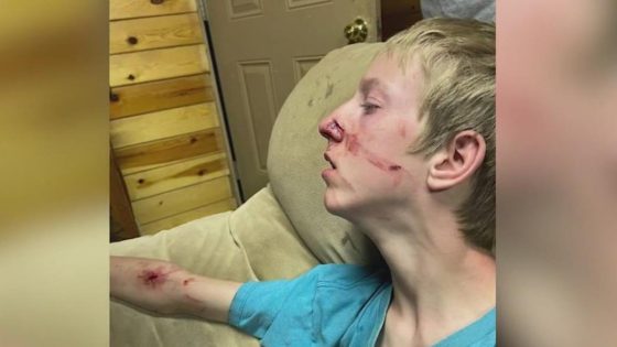 Family comes to rescue of 15-year-old attacked by a bear in Alpine – MASHAHER