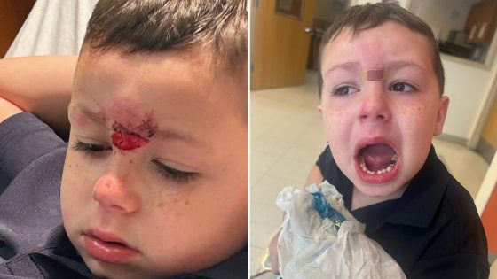 Pennsylvania dad demands answers after son, 5, has teeth knocked out in bloody assault at school, lawyer says – MASHAHER