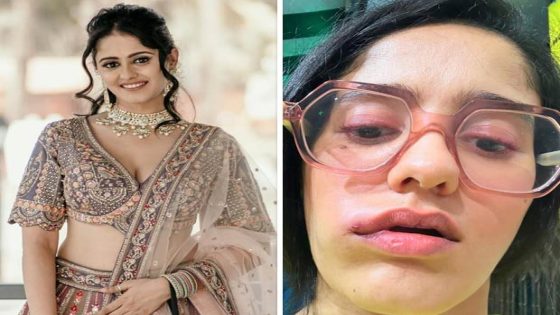 GHKKPM actress Ayesha Singh reveals ‘no accurate diagnosis’ for her face swelling; says, “I have connected with a third doctor, and yet we can’t pinpoint the root cause” : Bollywood News – MASHAHER