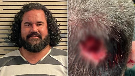 Florida man bit chunk out of deputy’s head at music festival: sheriff’s office – MASHAHER