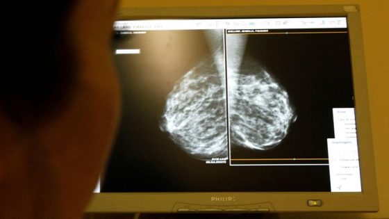 New breast cancer genes found in women of African ancestry, may improve risk assessment – MASHAHER