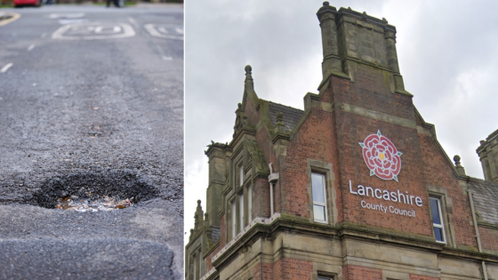 Student who dislocated ankle and couldn’t work for four weeks told by council that potholes are a ‘fact of life’ – MASHAHER