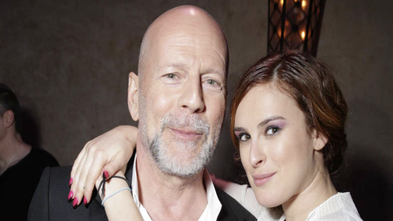 Bruce Willis’ daughter Rumer Willis reveals father is ‘doing ok’ amid ongoing aphasia and dementia battle – MASHAHER