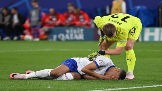 France’s Kylian Mbappé suffers bloodied, broken nose in Euro win over Austria, needs surgery – MASHAHER