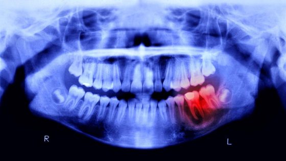 Humans May Be Able to Grow New Teeth Within Just 6 Years – MASHAHER