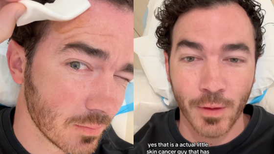 Kevin Jonas says it’s ‘time to heal’ after having skin cancer removed from his forehead. What is basal cell carcinoma? – MASHAHER