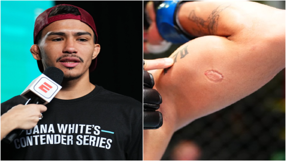 Igor Severino suspended nine months, fined $2K by NAC for UFC biting incident – MASHAHER