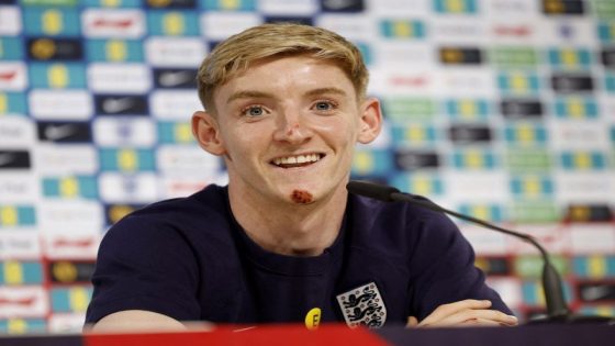 Football: Soccer-England’s Gordon promises to mark bike crash with goal celebration – MASHAHER