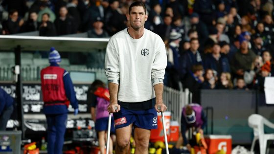 Tom Hawkins foot injury, scans, results, latest news, Chris Scott post-match press conference, Geelong Cats loss to Carlton Blues – MASHAHER