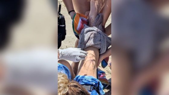 14-year-old is bitten by a shark at a North Carolina beach – MASHAHER