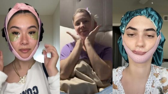 Why are people sleeping with a chin strap? Experts break down TikTok claims of slimmer faces and less snoring. – MASHAHER