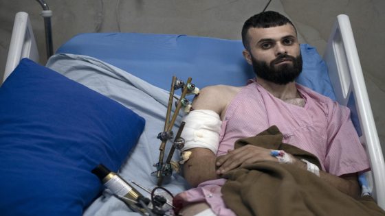 A Palestinian was shot, beaten and tied to an Israeli army jeep. The army says he posed no threat – MASHAHER