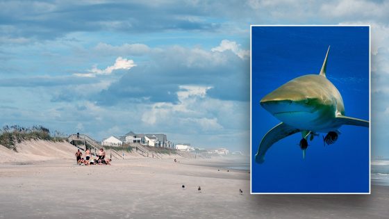 Shark bites teenager’s leg in attack at North Carolina beach – MASHAHER