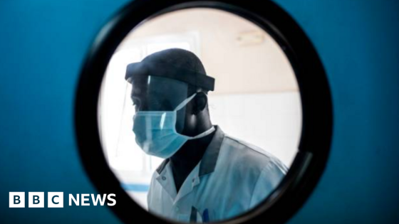 Last civilian hospital in Sudan city closed after RSF attack – MASHAHER