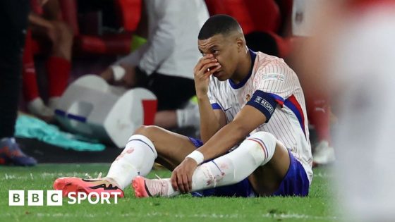 Kylian Mbappe: France captain ‘not doing well’ after nose injury – MASHAHER