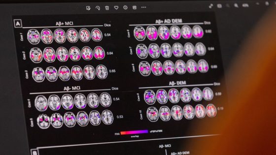 US professor charged with manipulating data for Alzheimer’s drug trial – MASHAHER