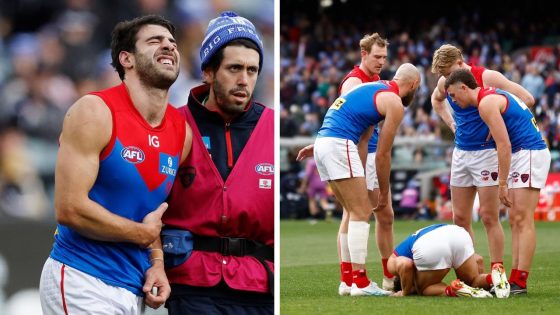 Christian Petracca hospitalised in King’s Birthday game, injured ribs, Melbourne Demons loss to Collingwood Magpies, latest news – MASHAHER