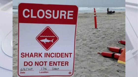 Shark attack off California coast leaves 46-year-man hospitalized, beaches closed – MASHAHER