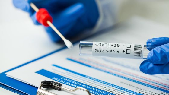 “No evidence” new COVID variant LB.1 causes more severe disease, CDC says – MASHAHER