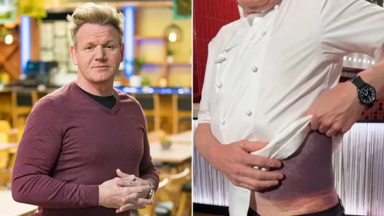 Gordon Ramsay ‘lucky’ to be alive following serious bicycle accident – MASHAHER