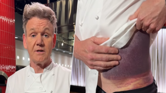 Gordon Ramsay says he’s ‘lucky to be alive’ after bike accident in Father’s Day message – MASHAHER