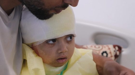 UK urged to admit 11 Gaza children hurt in the war for urgent treatment | World News – MASHAHER