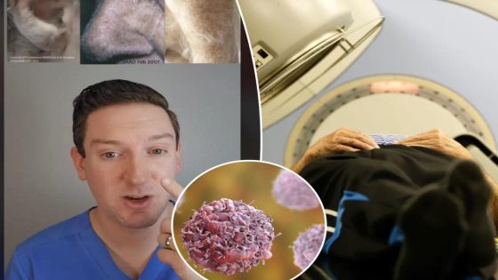 Don’t ignore this one skin sign that might mean cancer, doctor warns – MASHAHER