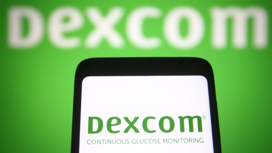 Dexcom shares plummet more than 30% after company lowers fiscal year guidance – MASHAHER